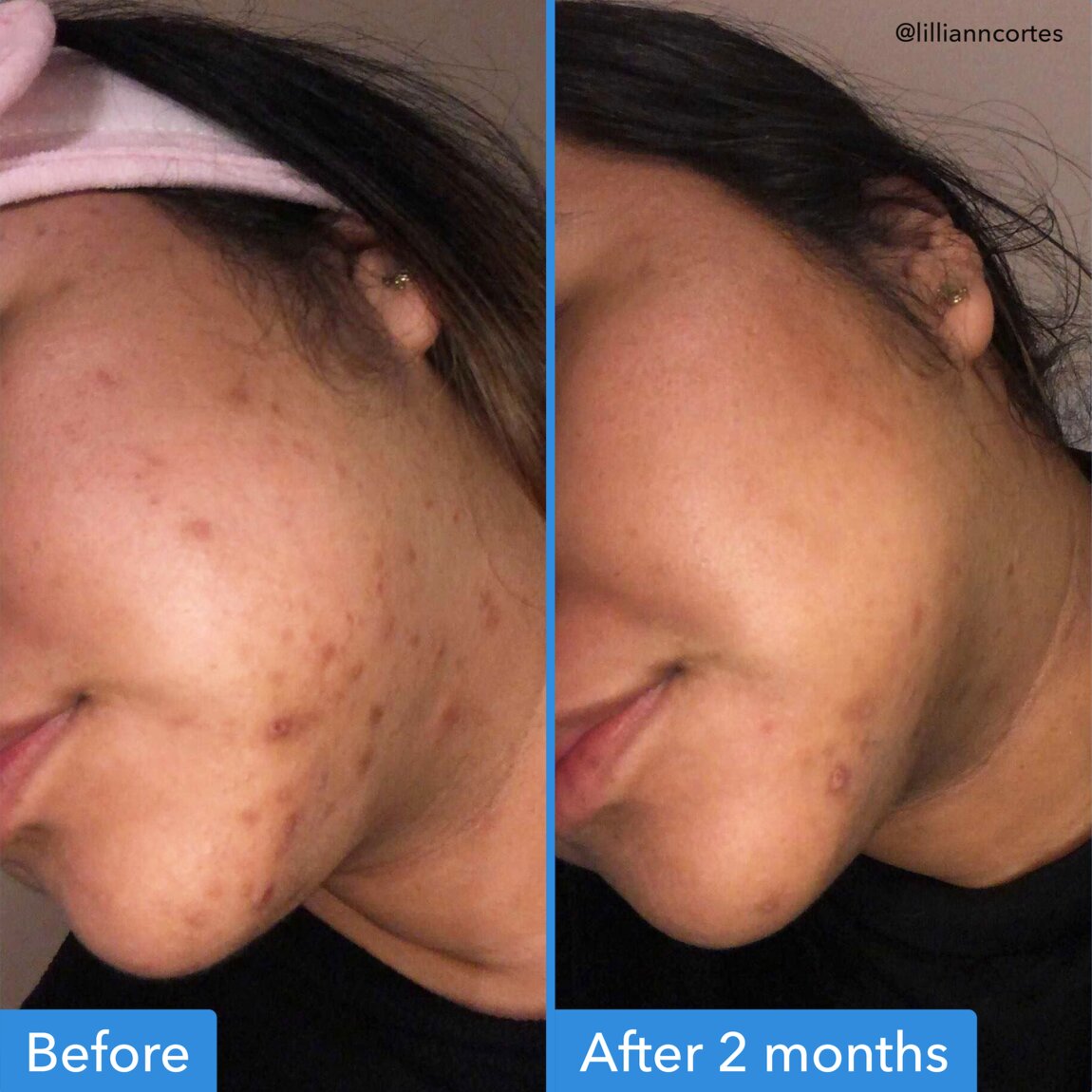 discoloration-correcting-serum-b7 zb_p.jpg