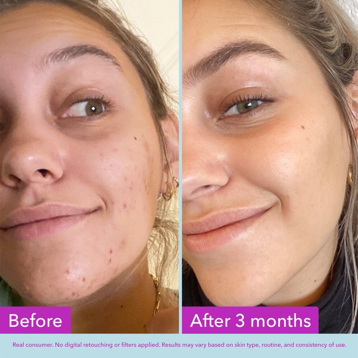 niacinamide-brightening-toner-e5 zb_p.jpg