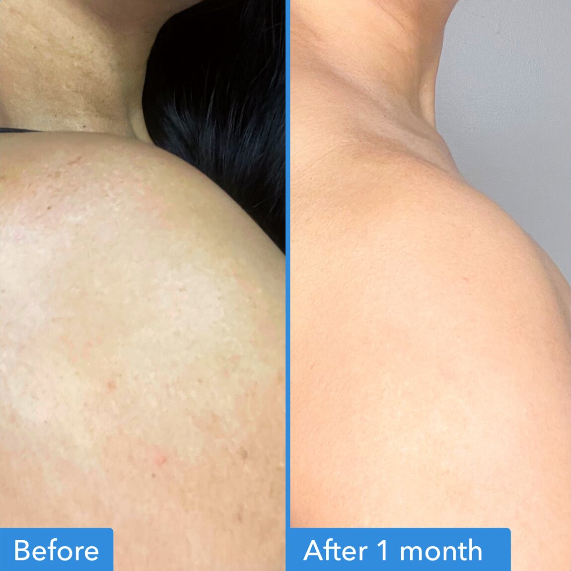 discoloration-correcting-body-treatment-s1 zb_p.jpg
