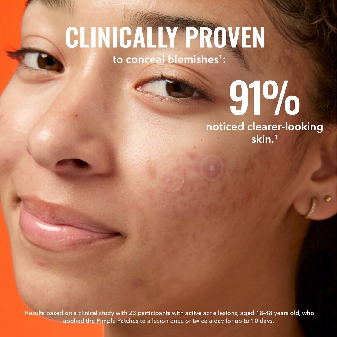 pimple-patches-l7 zb_p.jpg